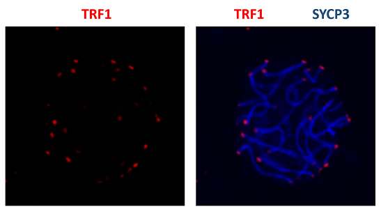 Immunofluorescence using mouse anti-TRF1 antibody